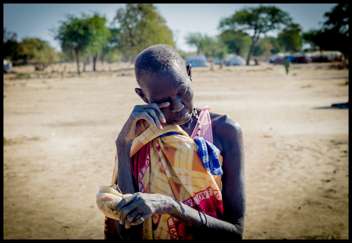 Sud Sudan, malnutrizione, conflitto, Azione contro la Fame