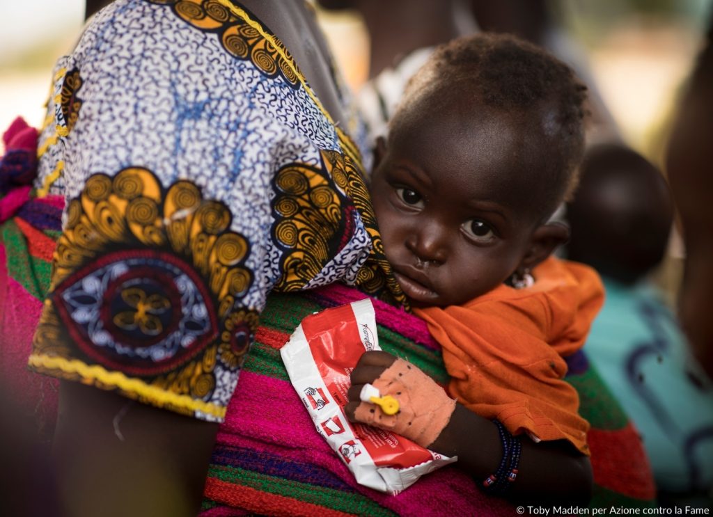 Malnutrizione infantile in Mali