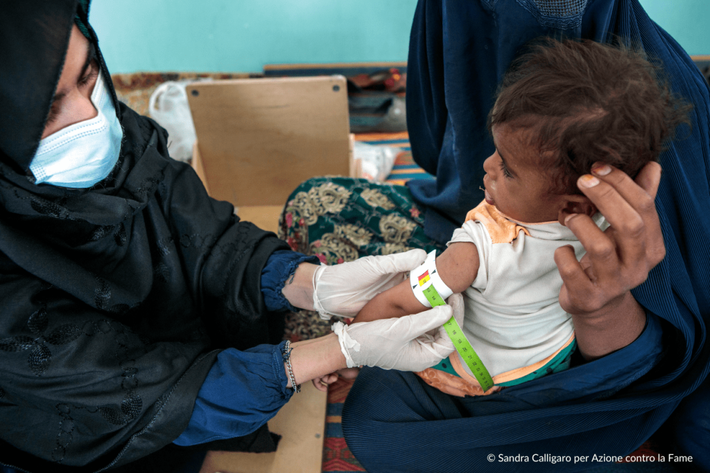 Diritti delle donne in Afghanistan oggi: infermiera misura la circonferenza del braccio di un bambino malnutrito