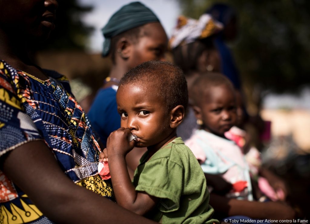 Madri e bambini con malnutrizione in Mali